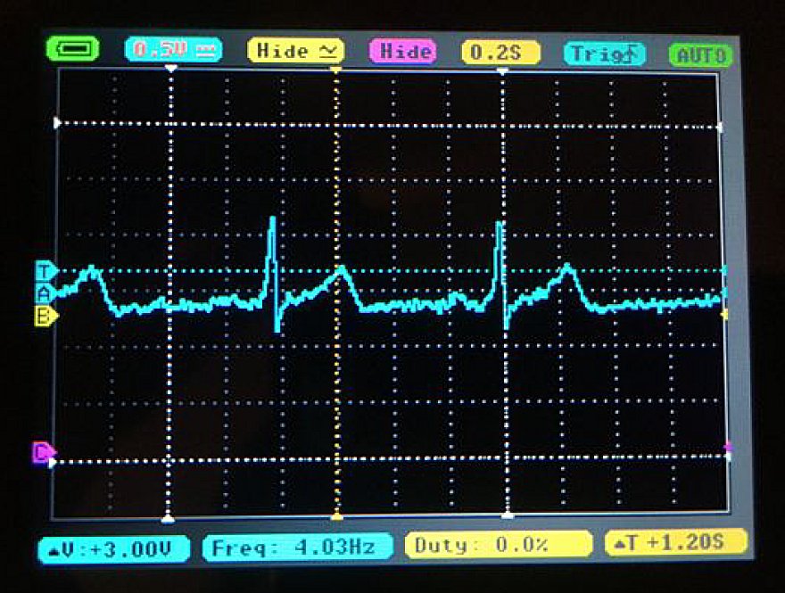 Biomedical Engineering Students Build Electrocardiogram Kits in Remote ...