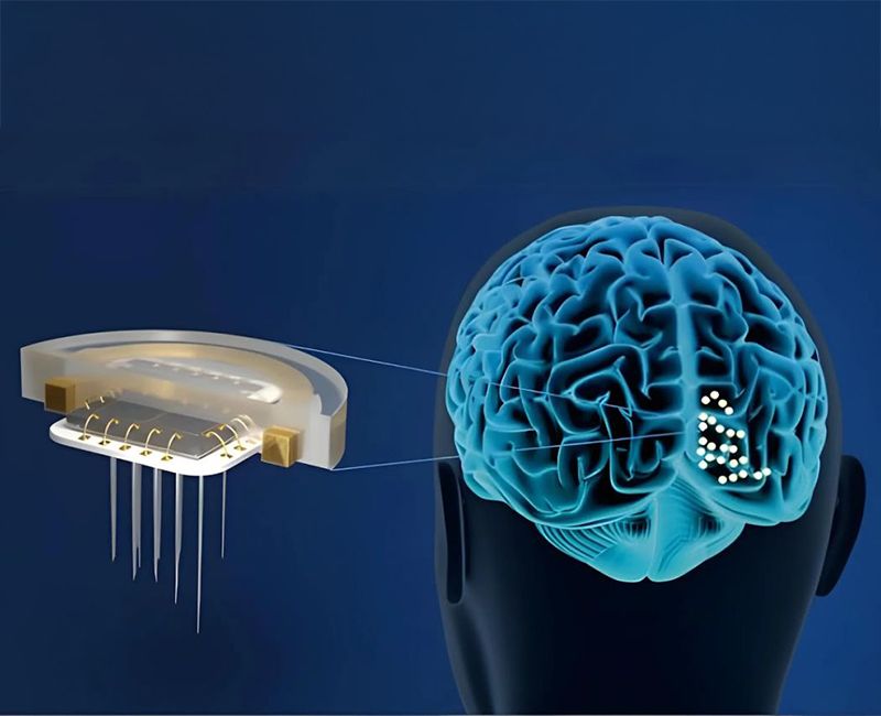 Graphic showing how Illinois Tech-led ICVD implant works